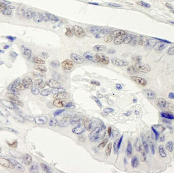 SYMPK / Symplekin Antibody (aa1224-1274)