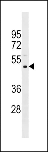 PRAMEF11 Antibody (aa188-214)