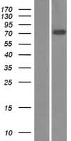 ZNF571 Protein (Over-Expression Lysate Myc-DDK (Flag))