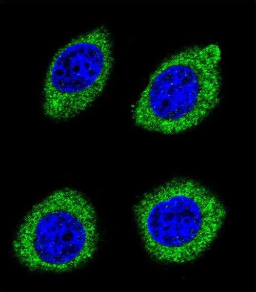 Polyclonal Rabbit anti-Human HSD11B1L Antibody (aa256-283, IHC, IF, WB)