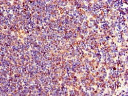 Polyclonal Rabbit anti-Human TXK / RLK Antibody (IHC, IF, WB)