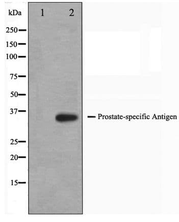 Polyclonal Rabbit anti-Human KLK3 / PSA Antibody (IHC, WB)