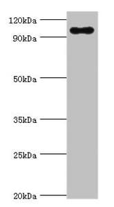 Trimethylguanosine Synthase 1 Antibody (aa714-853)