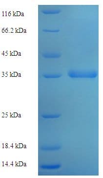 Human MPV17 Protein (Recombinant His-SUMO)