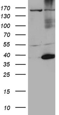 HSF2BP Antibody (aa1-181, clone OTI2A1)