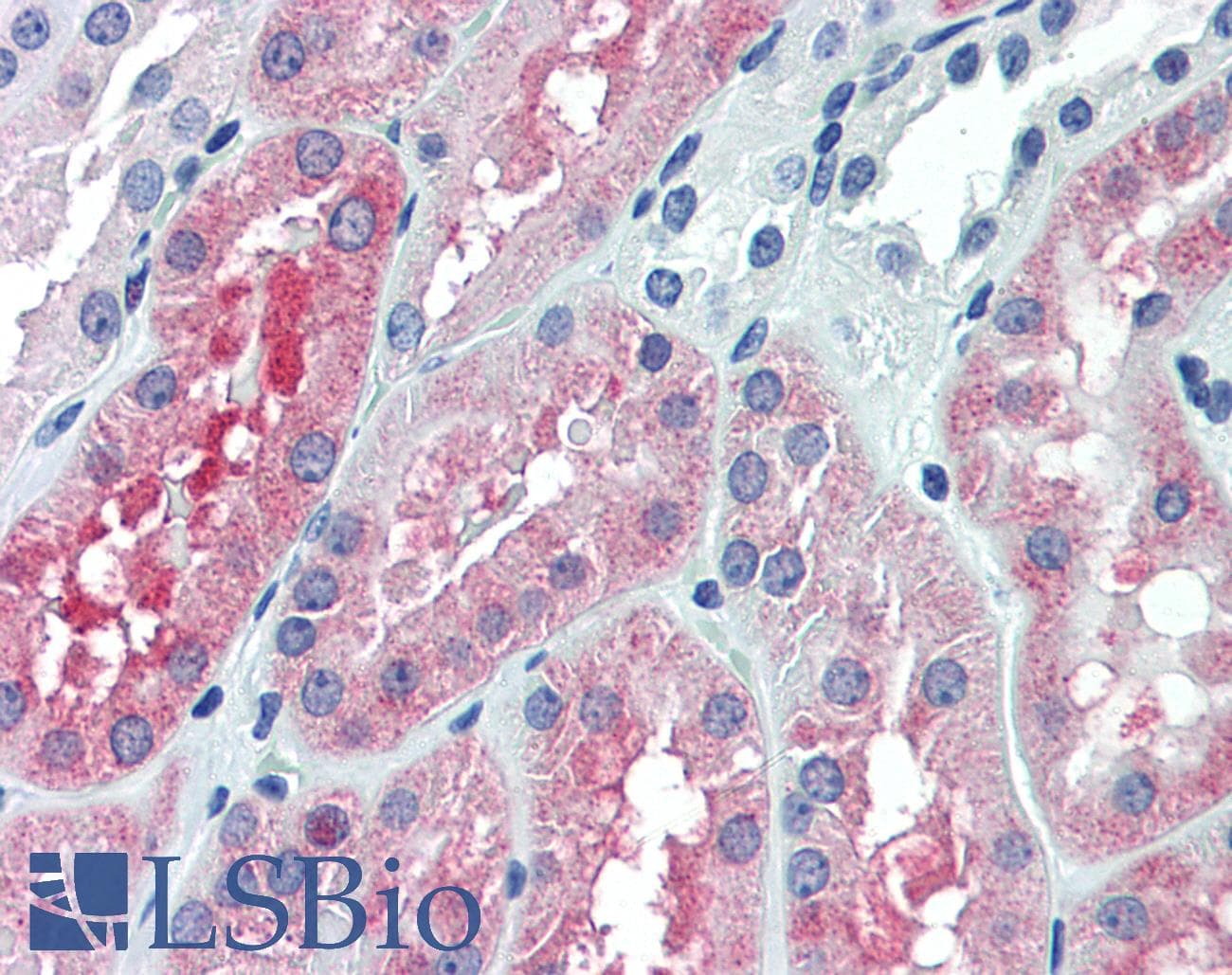 IHC-plus™ Monoclonal Mouse anti-Human OCRL Antibody (clone 4A6, IHC, WB)