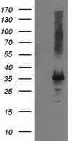 P5CR2 / PYCR2 Antibody (clone OTI2B11)