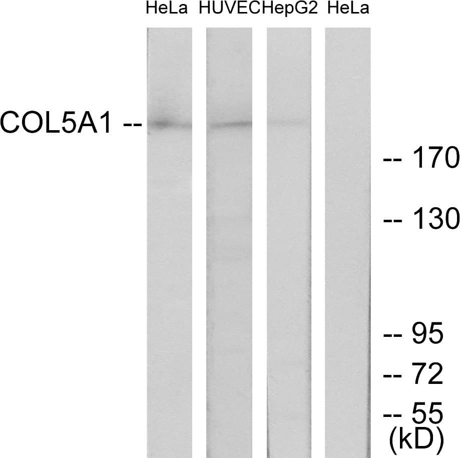 COL5A1 / Collagen V Alpha 1 Antibody (aa301-350)
