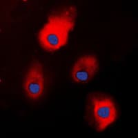 IHC-plus™ Polyclonal Rabbit anti-Human S100A1 / S100-A1 Antibody (N-Terminus, IHC, IF, WB)