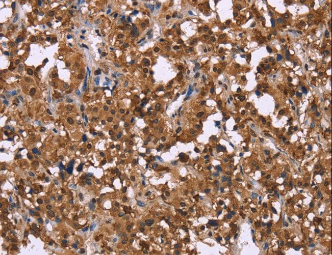 Polyclonal Rabbit anti-Human GPR171 Antibody (IHC)