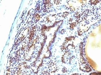 MAP3K1 / MEKK1 Antibody (aa1211-1310, clone 2F6)