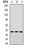 Polyclonal Rabbit anti-Human AP1M2 Antibody (IHC, WB)