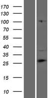 CFAP69 Protein (Over-Expression Lysate Myc-DDK (Flag))