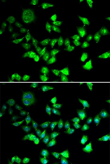 SMC1A / SMC1 Antibody
