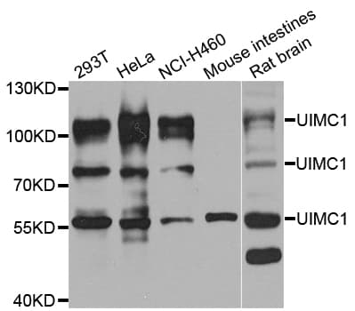 UIMC1 / RAP80 Antibody