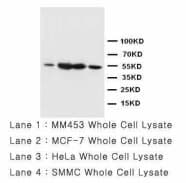 HDAC1 Antibody (aa1-14)