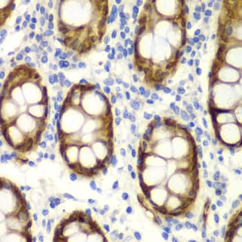 GIPC2 Antibody (aa1-315)