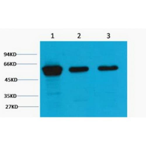 Vimentin Antibody (clone 1A7)