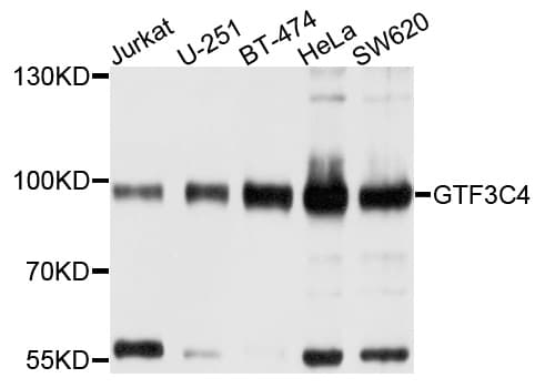 Polyclonal Rabbit anti-Human GTF3C4 Antibody (WB)