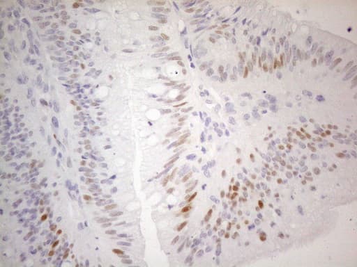 CDKN1A / WAF1 / p21 Antibody (aa2-164, clone OTI7C8)