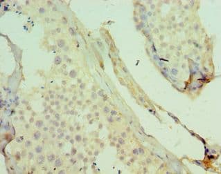 Polyclonal Rabbit anti-Human KDM4B / JMJD2B Antibody (aa1-260, IHC, WB)