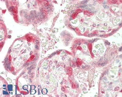 IHC-plus™ LRTOMT Antibody (aa 31-264)