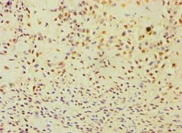 ANXA8L1 Antibody (aa1-276)