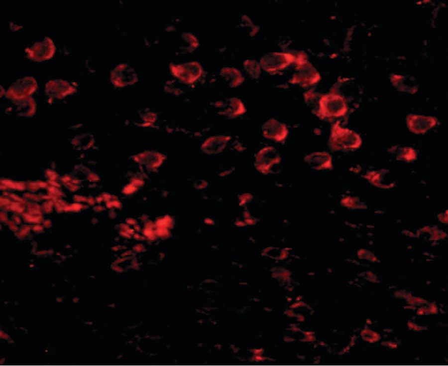 Polyclonal Rabbit anti-Human MATN4 / Matrilin 4 Antibody (IHC, IF, WB)