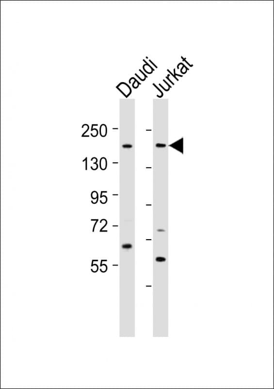 Polyclonal Rabbit anti-Human BZRAP1 / PRAX-1 Antibody (aa1551-1585, WB)