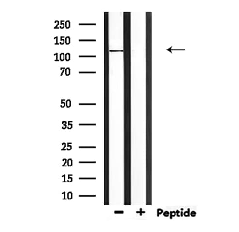 Polyclonal Rabbit anti-Human CCP110 Antibody (IHC, IF, WB)