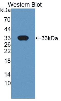 Basigin / Emmprin / CD147 Antibody (aa59-321)