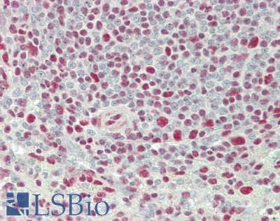 IHC-plus™ Polyclonal Rabbit anti-Human XRN2 Antibody (aa900-950, IHC, IF)