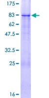 Human ZNF20 Protein (Recombinant GST)