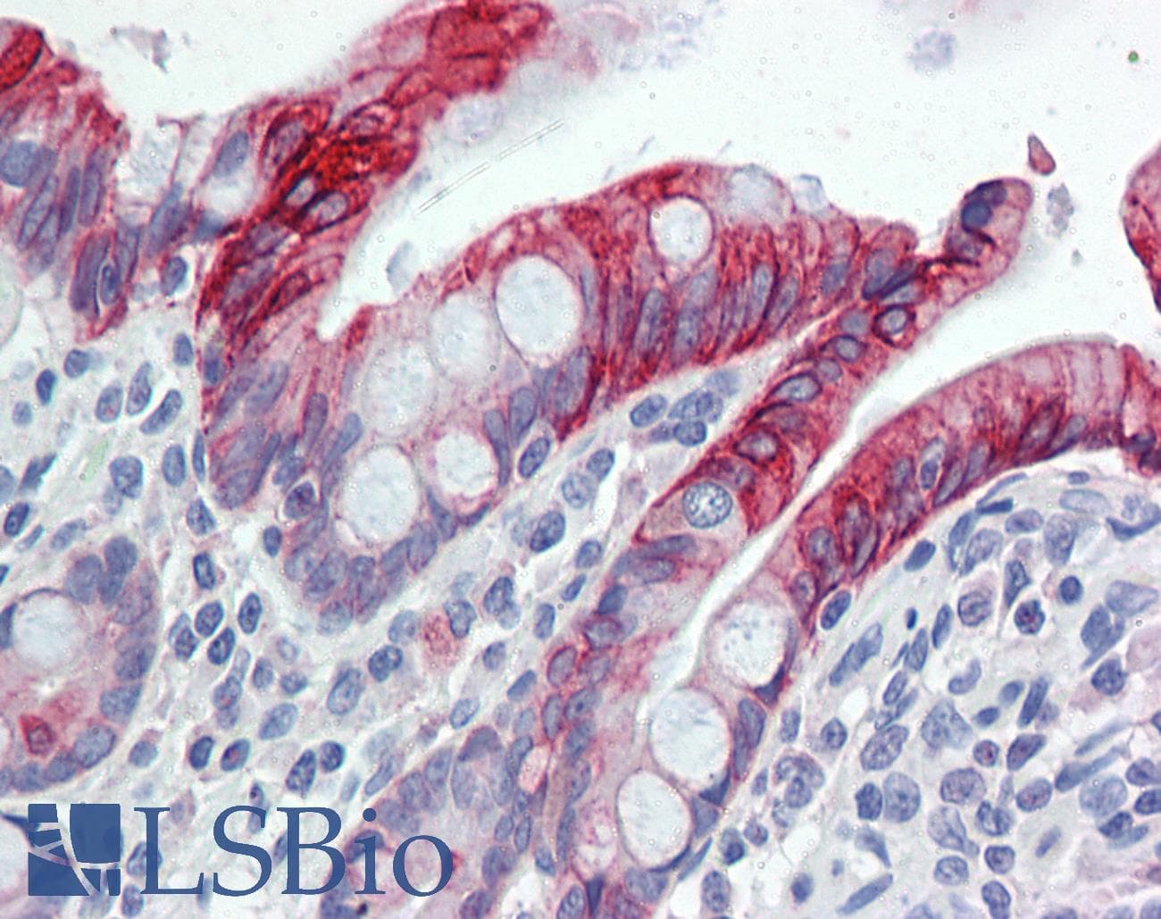 IHC-plus™ KRT20 / CK20 / Cytokeratin 20 Antibody (clone IT-Ks 20.10, FITC)
