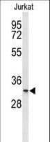 Polyclonal Rabbit anti-Human TMEM150A Antibody (aa81-108, IHC, WB)