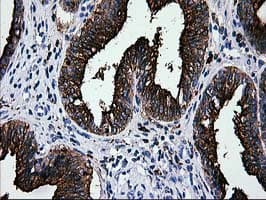 Monoclonal Mouse anti-Human MAC-2-BP / LGALS3BP Antibody (clone OTI6B7, IHC, WB)