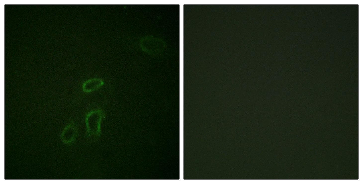 L1CAM Antibody (p1181)