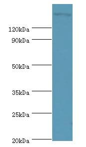 ROCK2 Antibody (aa1109-1388)