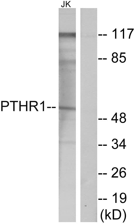IHC-plus™ PTHR / PTHR1 Antibody (aa145-194)