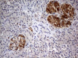 FEN1 Antibody (aa117-380, clone OTI1F3)
