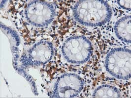 Monoclonal Mouse anti-Human ARHGAP25 Antibody (clone OTI12E6, IHC, IF, WB)