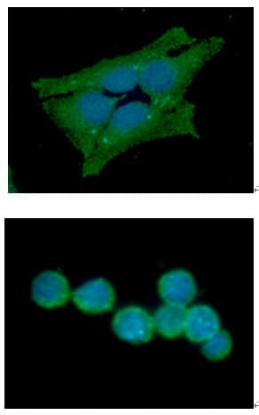 GSS / Glutathione Synthetase Antibody (clone AT12F2)