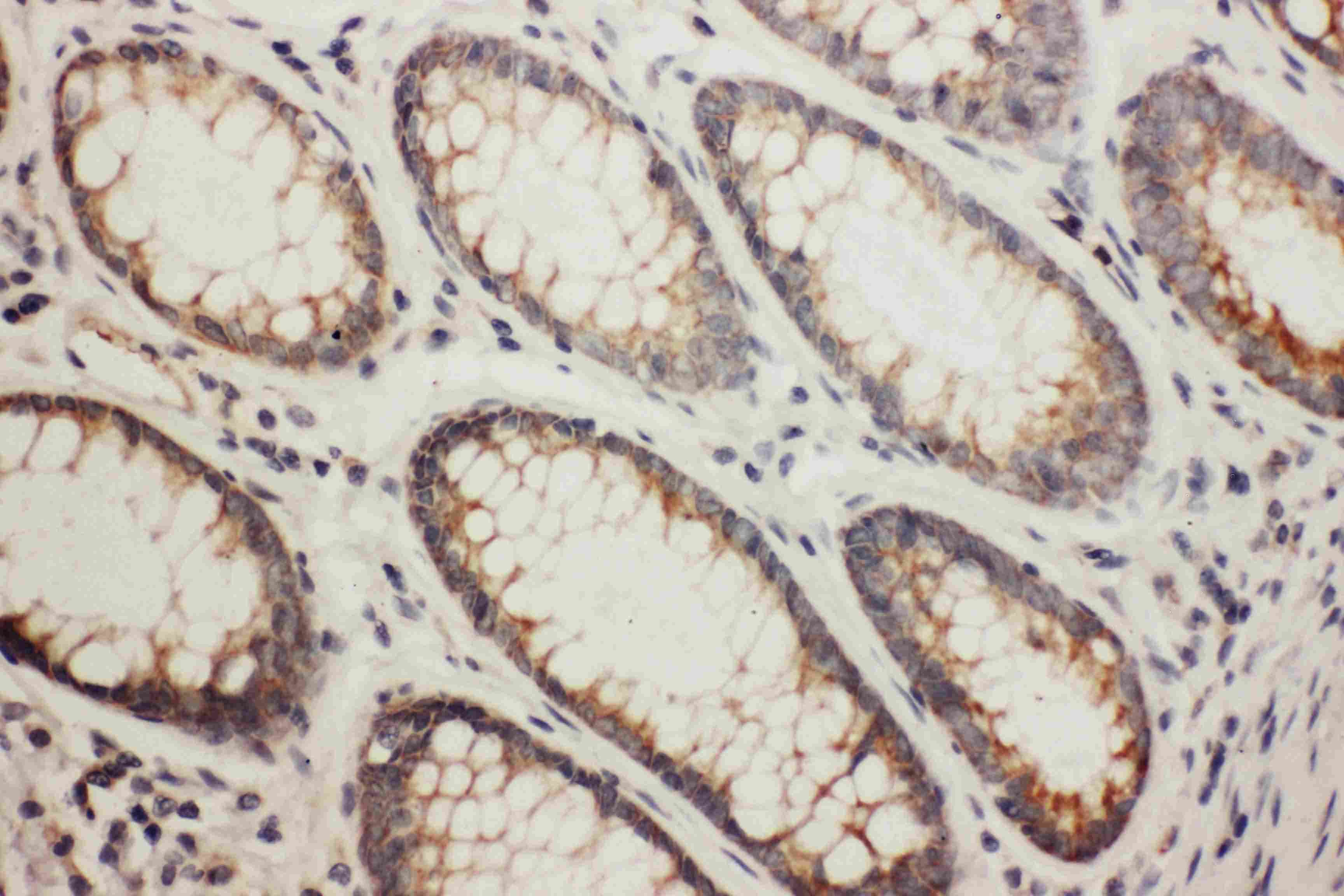 Polyclonal Rabbit anti-Human NDRG1 Antibody (aa194-214, IHC, WB)