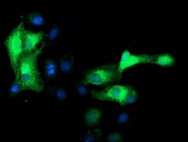 IHC-plus™ MAPRE2 / EB2 Antibody (clone 1F3)