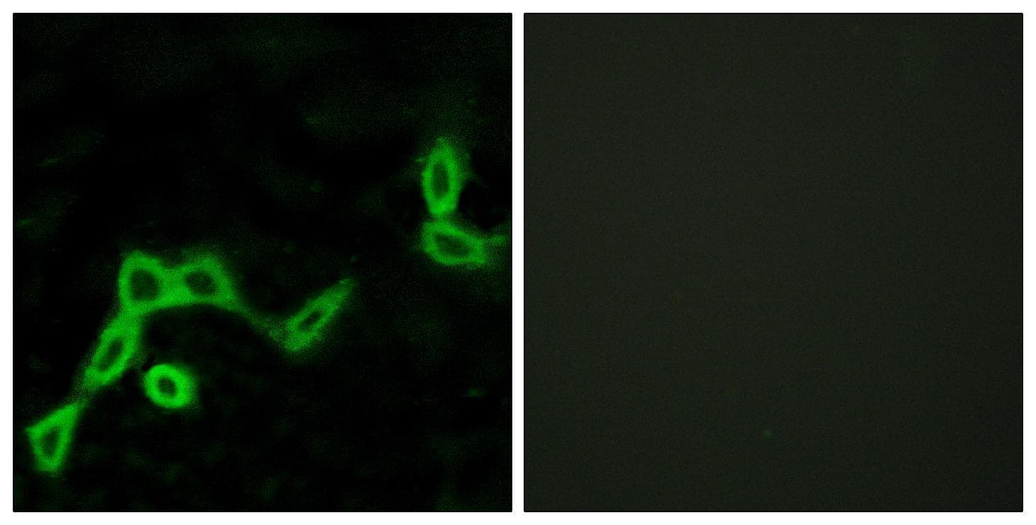 KISS1R / GPR54 Antibody