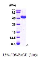Human GRHPR / Glyoxylate Reductase Protein (Recombinant His)