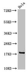 Polyclonal Rabbit anti-Human RPS15 / Ribosomal Protein S15 Antibody (IHC, IF, WB)