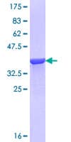 Human AGXT / SPT Protein (Recombinant GST, N-terminus)