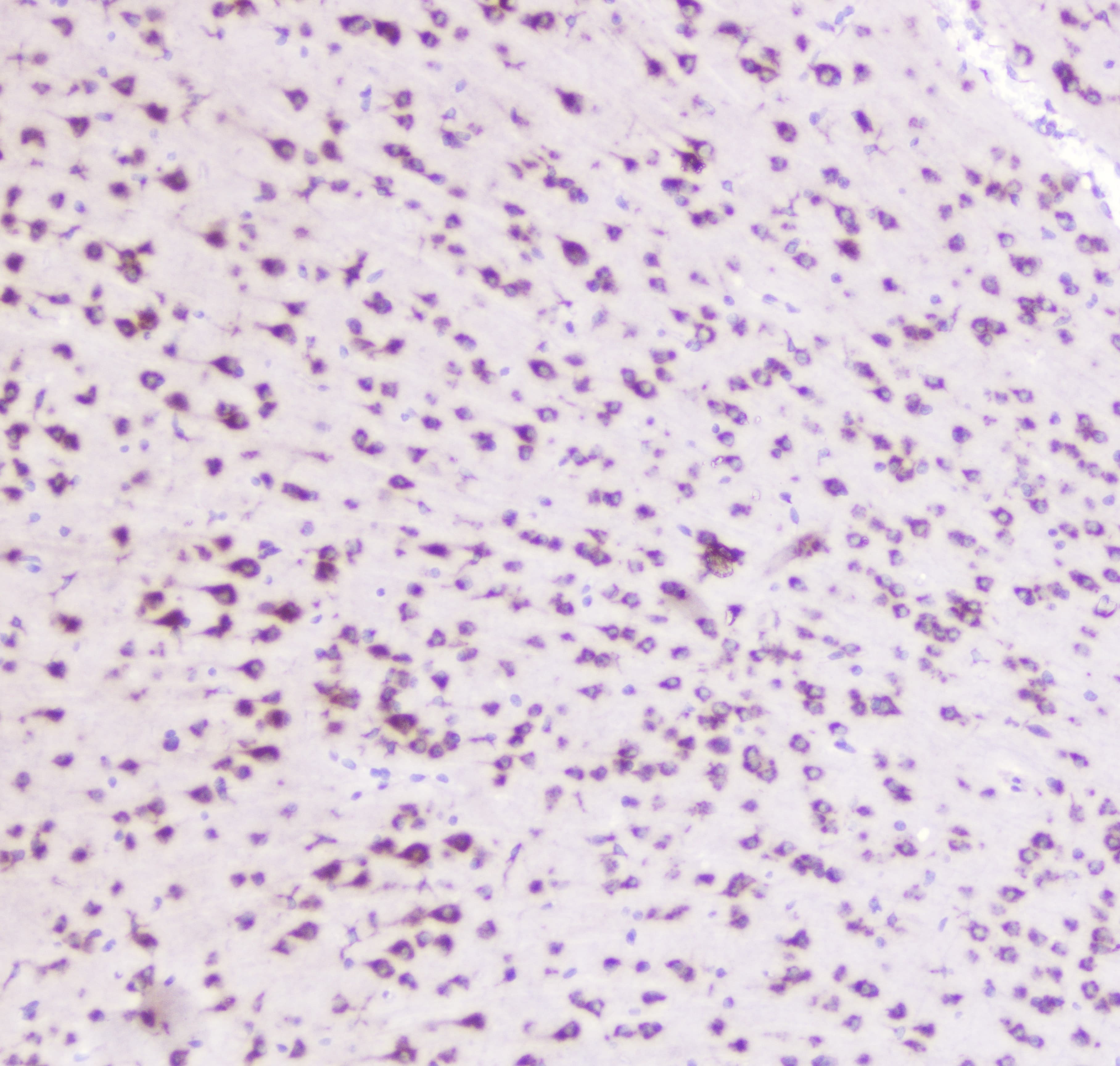 Polyclonal Rabbit anti-Human GOLGA2 / GM130 Antibody (IHC, WB)