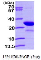 Human PHAP1 / ANP32A Protein (Recombinant His)